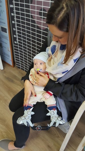Baby_Clubfoot_clothing
